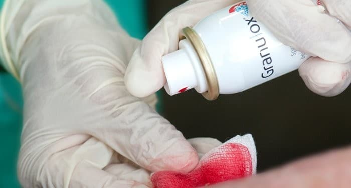 Granulox Haemoglobin Spray Application